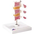 Fabrication Enterprises 3B® Anatomical Model - Deluxe Osteoporosis (3 Vertebrae) 1062096